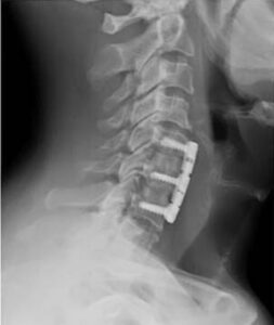 in the Kharkiv hospital - Is It Necessary to Buy Travel Insurance?